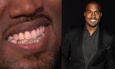 Kanye West gigi berlian